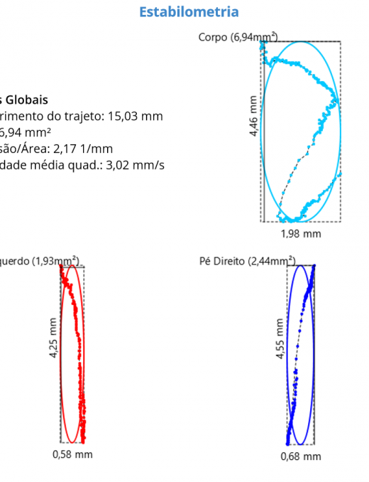 estabilometria01
