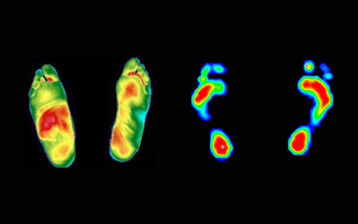 termografia e baropodometria
